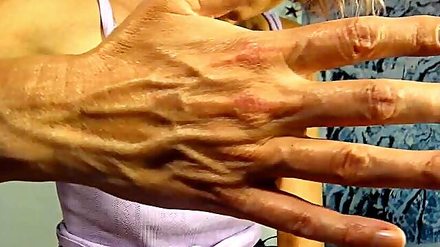 Veins on my hands and forearms