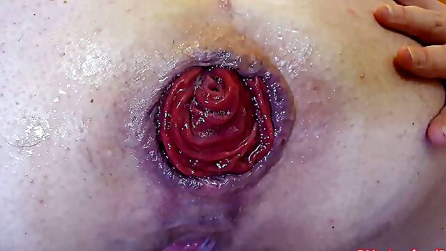 Extreme anal with prolapsing