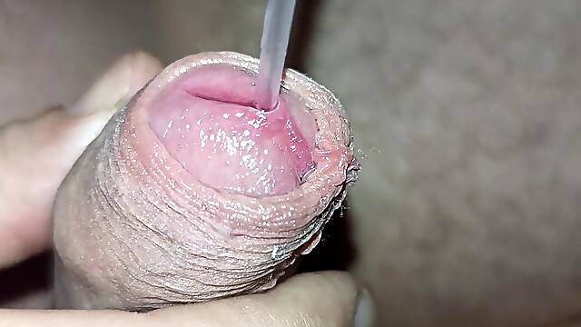 Ureal Insertion I'm Putting a Catheter in My Husband, It Hurts Him