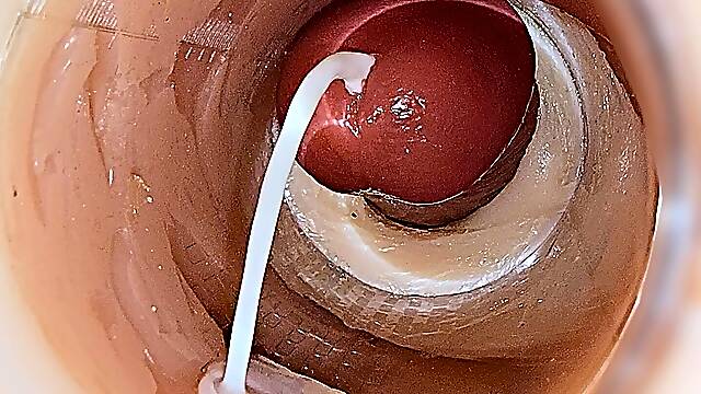 Camera Inside Deep Pussy Captures Huge Ejaculation of Sperm